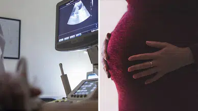Tıp dünyası bu vakayı konuşuyor: Karaciğerinde 12 haftalık bebek