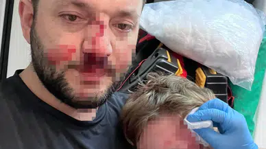 Yalova'da komşu dehşeti: 14 aylık bebek hastanelik oldu