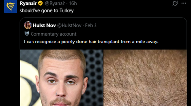 Türkiye'deki saç ekimi sektörü: Justin Bieber'ın saçlarına ilginç yorum