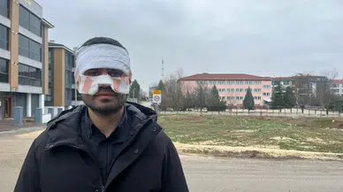 Öğretmenin öğretmene şiddeti: Rehber öğretmenin yüzünü sıcak çayla yaktı