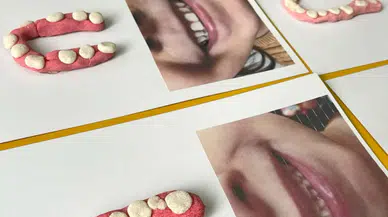 Ağız ve diş sağlığında sınıfta kaldık: Diş fırçalamaya 2 dakika ayırmıyoruz