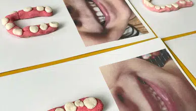 Ağız ve diş sağlığında sınıfta kaldık: Diş fırçalamaya 2 dakika ayırmıyoruz