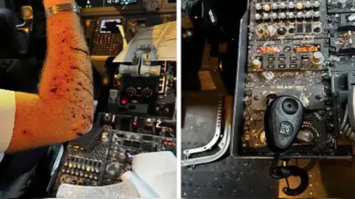 İnanılmaz olay: Uçağa meteor çarptı, pilot yaralandı