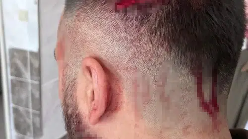 Veli öğretmeni öldüresiye dövdü: O anlar kamerada