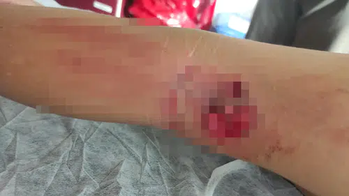 Okula giden çocuğa sokak köpeği saldırdı