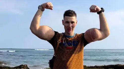 Kollarını kaybedecek: Ruya'nın Temel Reis'i