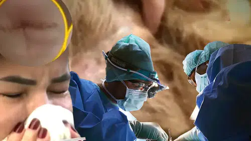 Doktor hastanın kafasında iğne unuttu: Sonrası korku filmi gibi