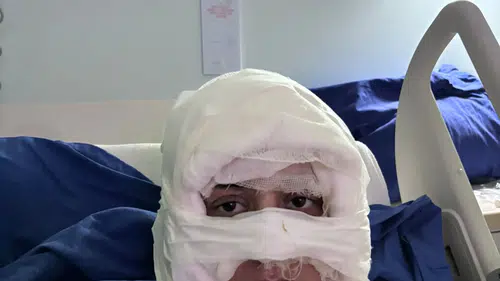 Dehşet anları: Genç kadın başka bir kadın tarafından ateşe verildi