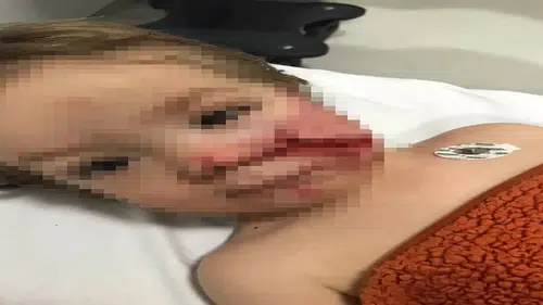 Pitbul dehşeti: 1,5 ve 5 yaşındaki kardeşler yaşam mücadelesi veriyor