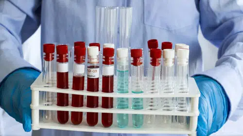 İlginç araştırma: COVID aşısı olanların ölme riski daha düşük çıktı