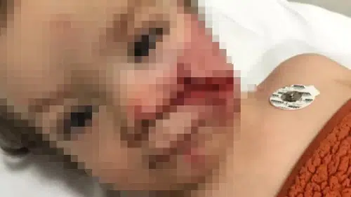 Pitbul dehşeti: 1,5 ve 5 yaşındaki kardeşler yaşam mücadelesi veriyor