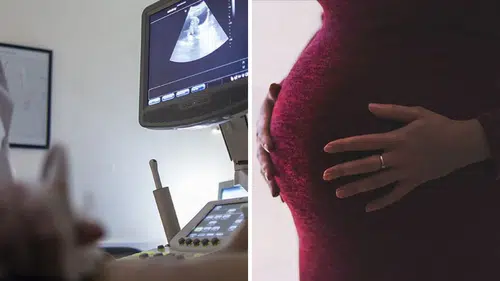 Tıp dünyası bu vakayı konuşuyor: Karaciğerinde 12 haftalık bebek