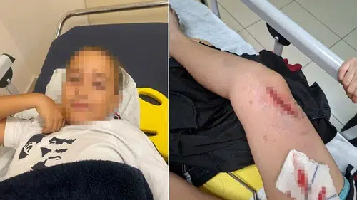 Bu çocuk ölümden döndü: Okulda bayrak direği üzerine devrildi