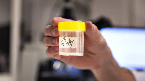 Türkiye'de sperm bankası var mı: Sperm bağışı yasaları ülkeye göre değişiyor