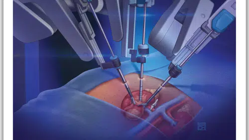 Robotik cerrahi doktorsuz ameliyat mı: Vatandaş kaygılı