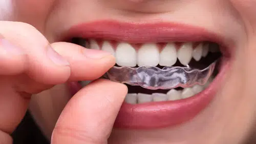 Diş sıkanların sayısı artıyor mu:  Belirtileri ağzımızın içinde saklı