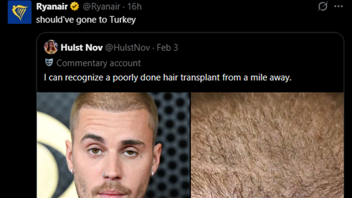 Türkiye'deki saç ekimi sektörü: Justin Bieber'ın saçlarına ilginç yorum