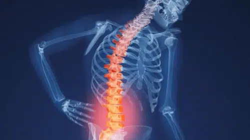 Atmosferdeki karbondioksit artı: İklim krizi kemiklerimizi eritiyor