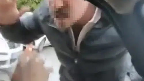 Bu görüntünün faturası 430 bin lira oldu