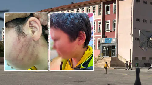 Konya'daki okulda kabus! Gelin ve kaynana öğrenciyi darp etti iddiası