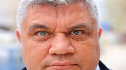 Bu adamın gözleri 3 renkli: Annesi "farklı olsun" diye dua etmişti