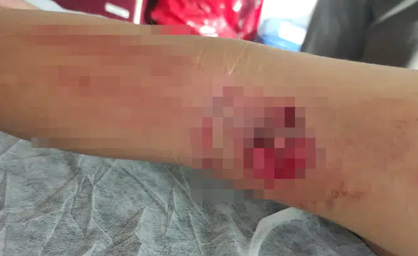 Okula giden çocuğa sokak köpeği saldırdı