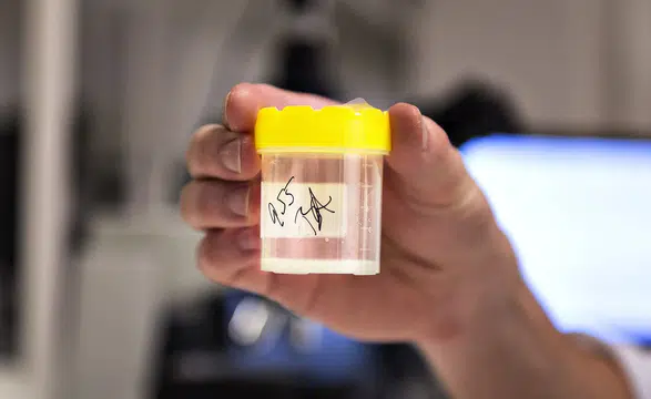 Türkiye'de sperm bankası var mı: Sperm bağışı yasaları ülkeye göre değişiyor