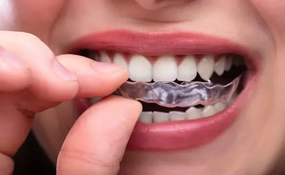 Diş sıkanların sayısı artıyor mu:  Belirtileri ağzımızın içinde saklı