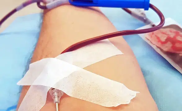Plazmaferez nedir: Vücudumuzdaki kanı temizletmenin riski