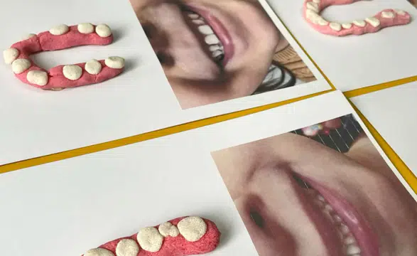 Ağız ve diş sağlığında sınıfta kaldık: Diş fırçalamaya 2 dakika ayırmıyoruz