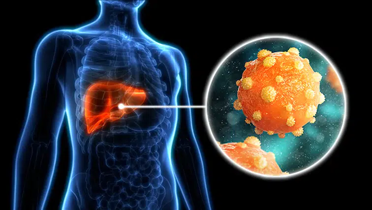 Uzmanlar Konya'dan uyardı: Hepatit hastalığında erken tanı önemli
