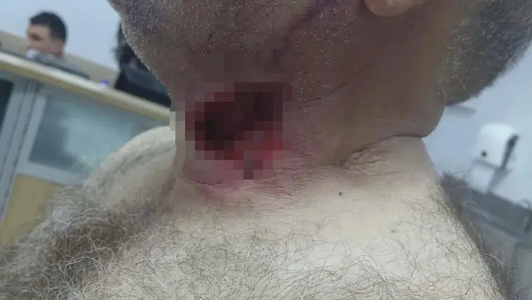 At sahibini boğazından ısırarak ağır yaraladı