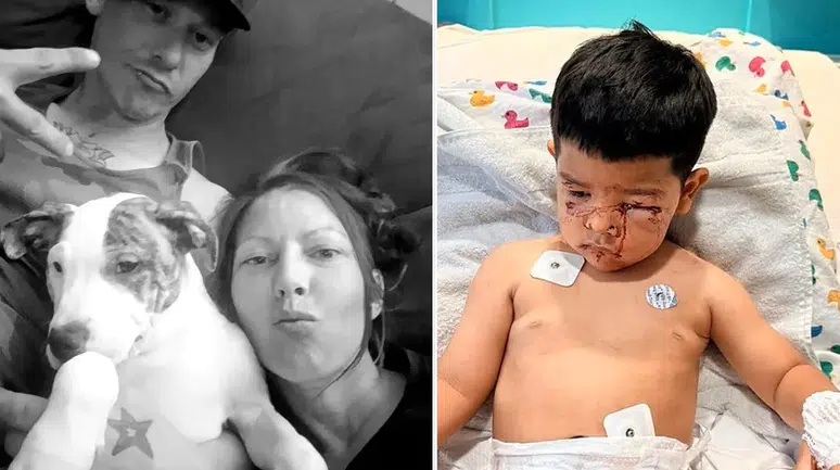 Pitbull dehşeti: Komşunun köpeği çocuğun yüzünü parçaladı