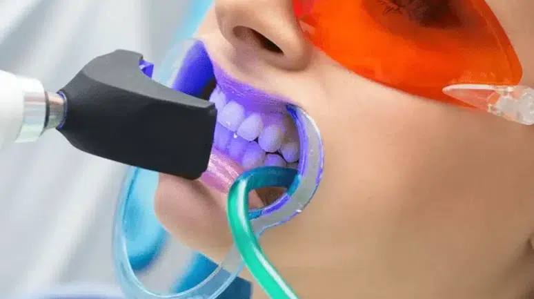 Sosyal medyadaki "beyaz diş" tuzağı: Uzmanından uyarı