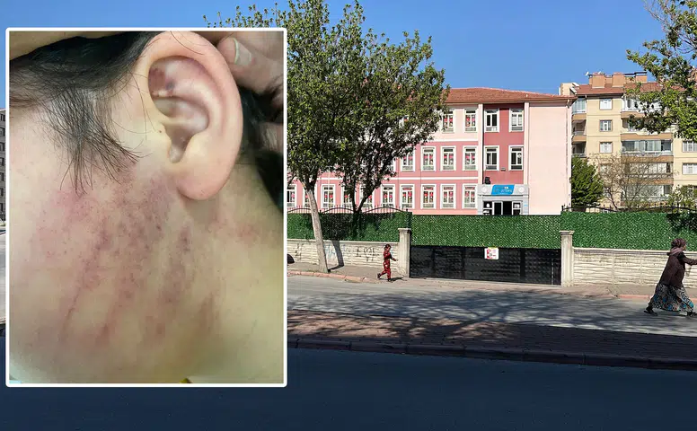 Konya'da çok konuşulan okul kavgasında kritik gelişme: Silah sayıldı