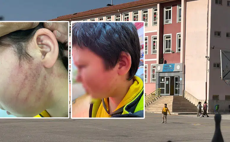 Konya'daki okulda kabus! Gelin ve kaynana öğrenciyi darp etti iddiası