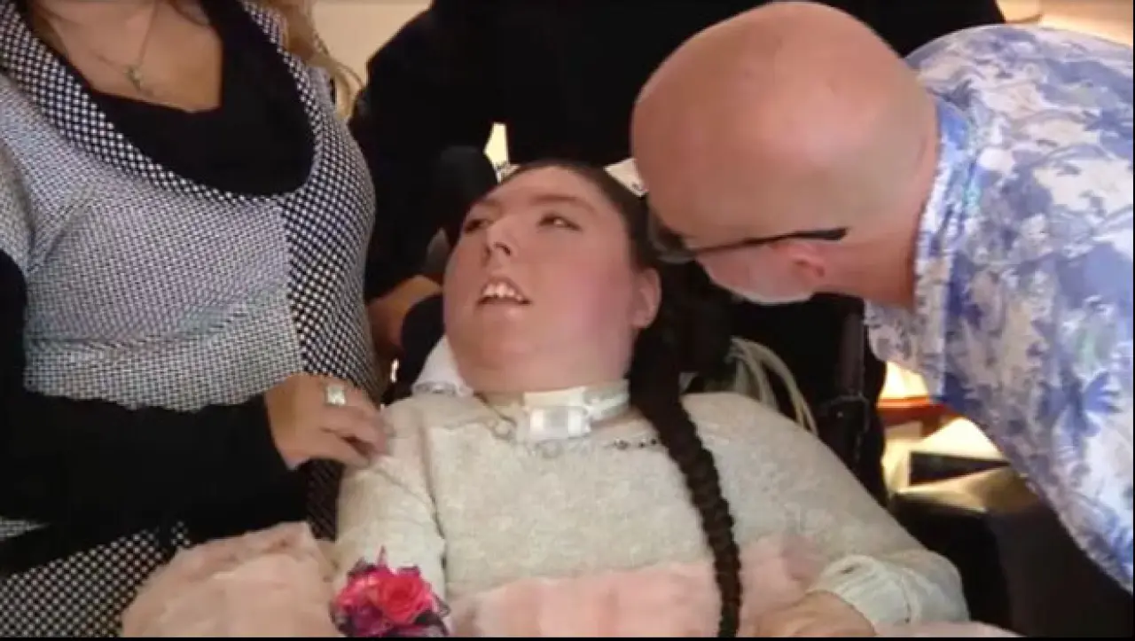 Beyni olmadan dünyaya gelmişti: Doktorlar 5 yıl bile yaşamaz dedi, şimdi 20 yaşında - 1. Resim