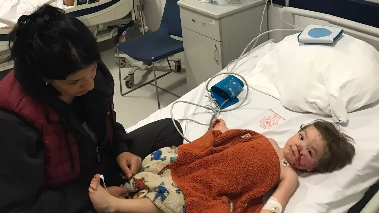 Apartmanda kan donduran saldırı! Pitbull cinsi köpek 1,5 yaşındaki bebeğin yüzünü parçaladı