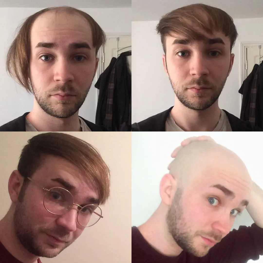Me, 24, Before & After visiting r/bald for the first time last night.  Thanks, all : r/bald