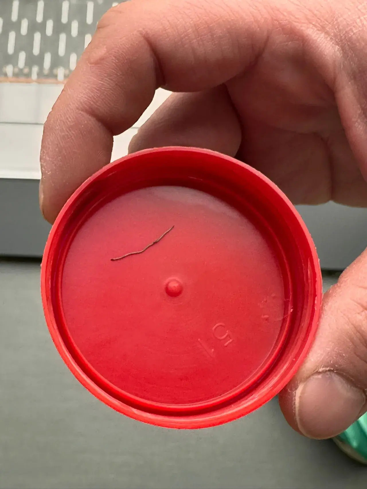 Böylesini ne gördük ne duyduk! 1 yaşındaki bebeğin sırtından zımba teli çıktı